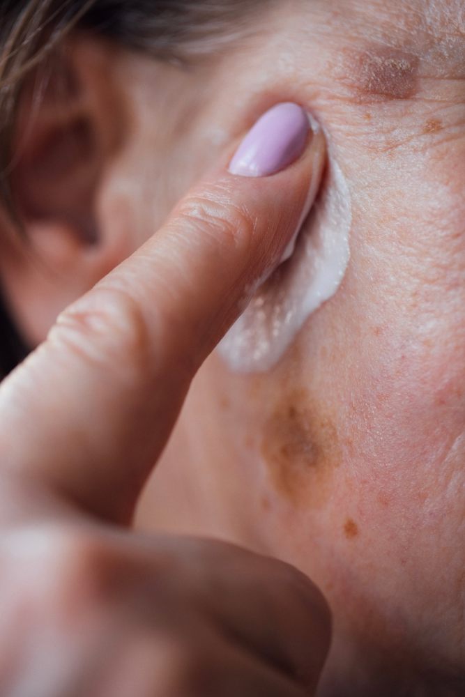 Pigmentation & Brightening